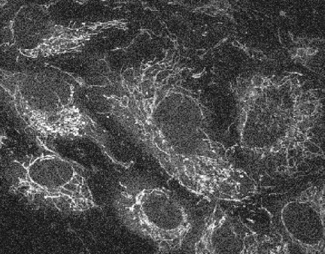 Autofluoreszenz (AF) von kultivierten Human Retinal Microvascular Endothelial Cells (HRMEC) mit Zwei-Photonen-Mikroskopie