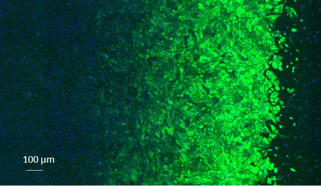 Fluoreszenzaufnahme von angefärbten Zellen