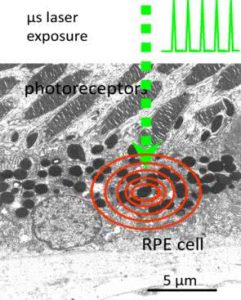 Histologisches Bild der Retina mit Veranschaulichung des Wirkungsmechanismus der SRT